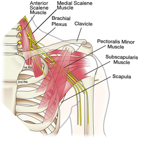 Main Image — Muscle-pain-msucle-pian-bracheal-plexus-carpal-tunnel-Herrington-Family-Chiropractic-500×498-490×500
